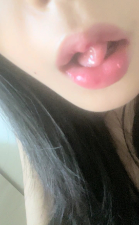 영하5도_210908_100개