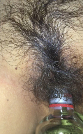 꽐라여친_보지에 맥주병 쑤시기